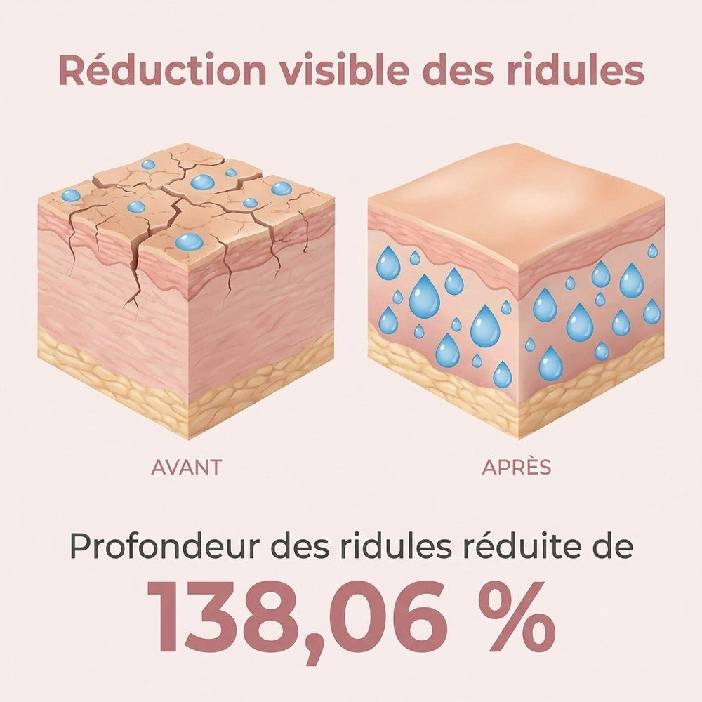 Infographie : profondeur des rides réduite