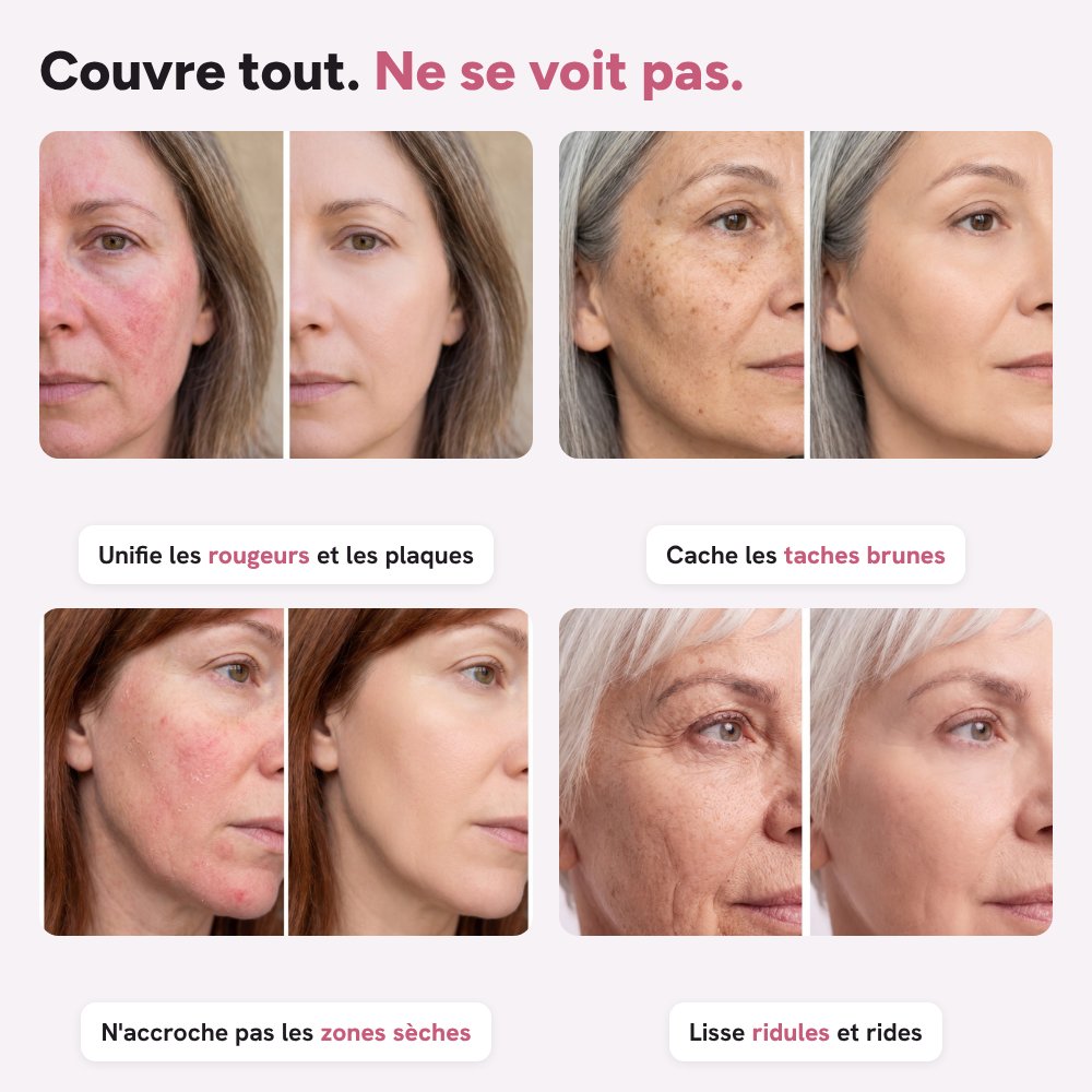 Couvre tout, ne se voit pas : rougeurs, taches, zones sèches, rides